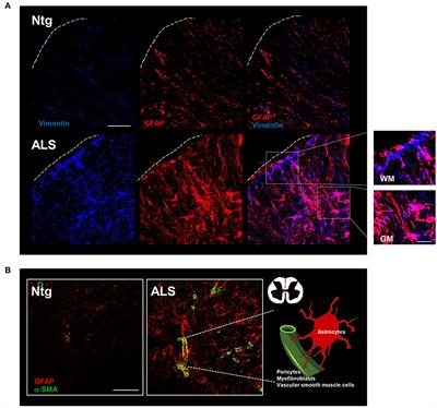 Fibrotic Scar in Neurodegenerative Diseases